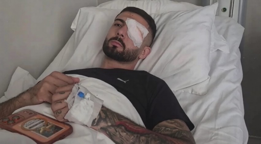 “Plumbi është ende aty”: Rrëfimi tronditës i 28-vjeçarit që u plagos në sy gjatë protestës