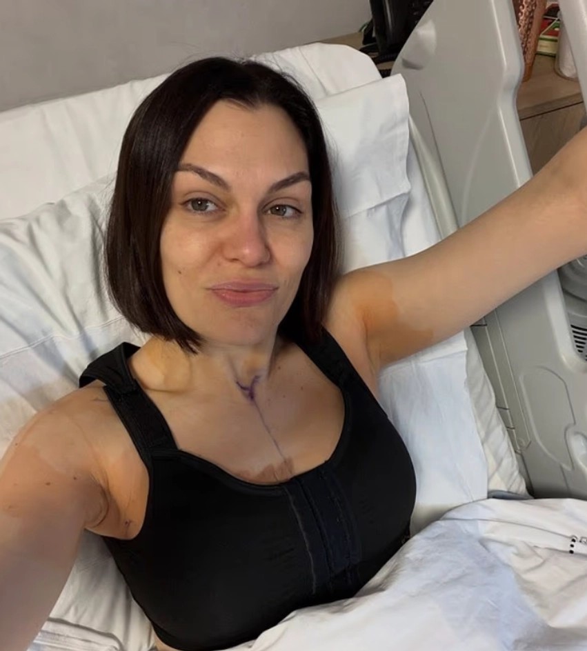 Jessie J rishfaqet në rrjetet sociale pas ndërhyrjes së dytë kirurgjikale: Artistja ndan pamje nga spitali dhe mesazhe optimizmi