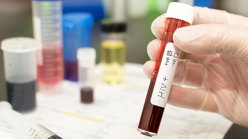 Të dhënat e reja të ISHP-së: Tetë raste me HIV/AIDS gjatë shtatorit, dy humbin jetën