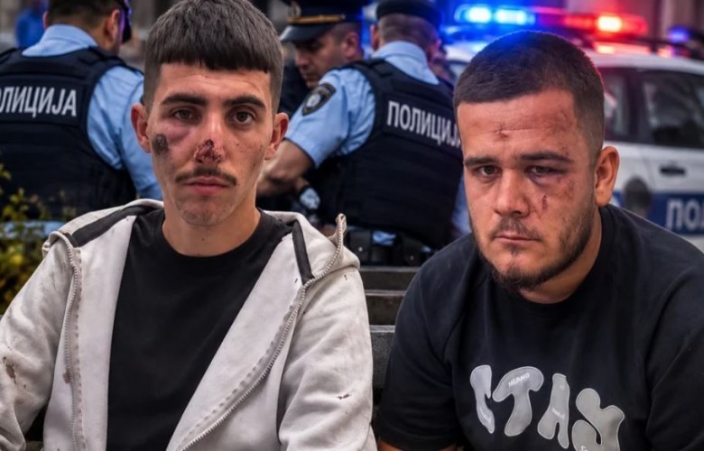 Skandal në Shkup: Dy të rinj shqiptarë pretendojnë se u bënë pre e dhunës brutale të policisë