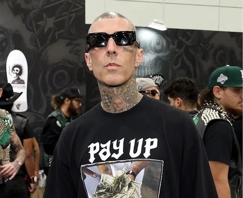 Travis Barker pas operacionit: Bateristi i Blink-182 zbulon detajet e ndërhyrjes kirurgjikale