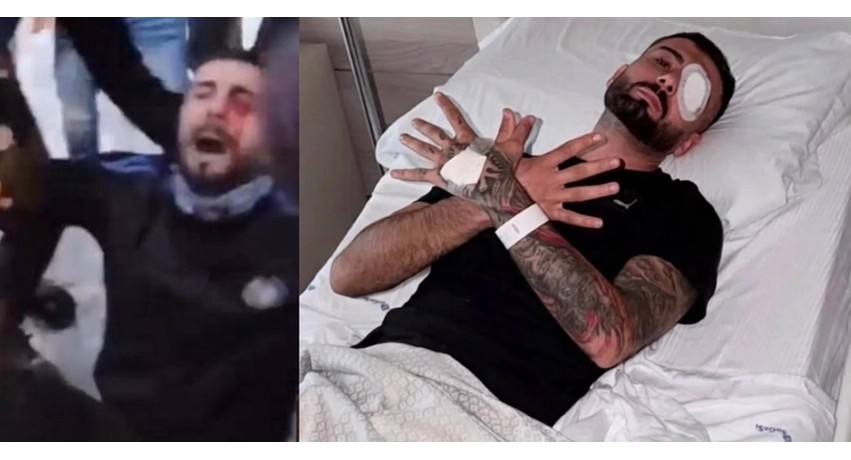 Ndërhyrje e suksesshme në Romë, mjekët italianë i shpëtojnë syrin tifozi shqiptar Erjon Vishkulli